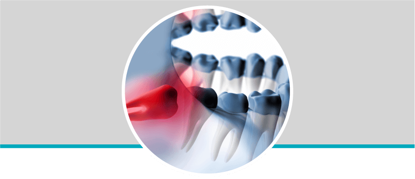 Cirugía oral y maxilofacial