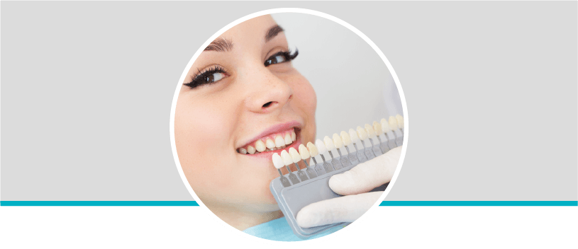 Diseño de sonrisa